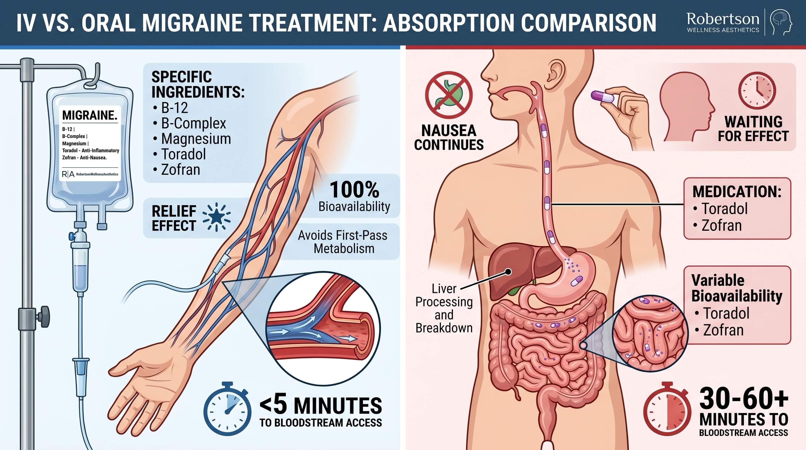 Split infographic showing IV migraine treatment on the left with an IV bag and rapid bloodstream delivery, vs. oral/nasal meds on the right with timelines and absorption.