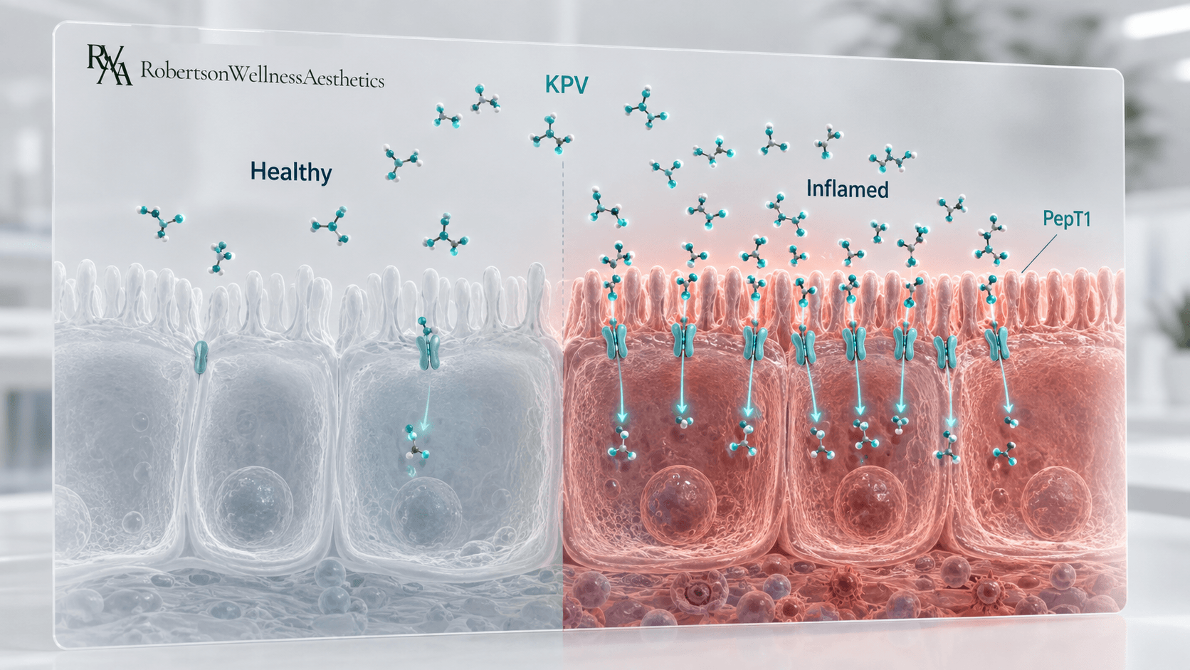 How does KPV work