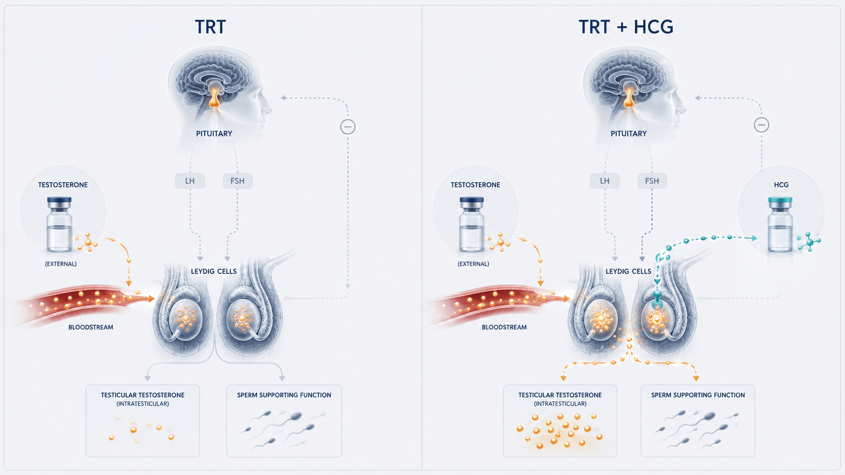 TRT alone vs TRT + HCG