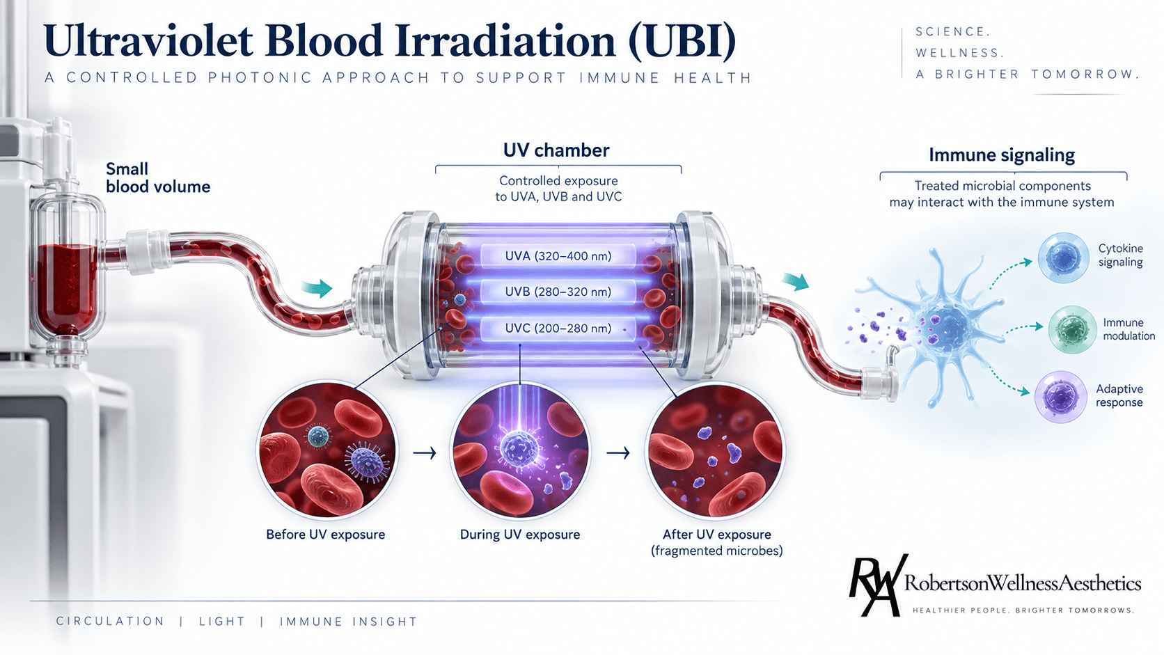 How ultraviolet blood irradiation (UBI) works